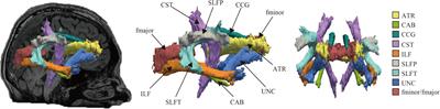 Sex Differences in White Matter Pathways Related to Language Ability